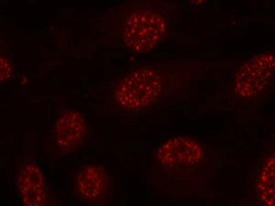 Immunofluorescence staining of methanol-fixed Hela cells using MAPKAPK-2(Phospho-Thr334) Antibody.