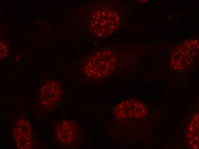 Immunofluorescence staining of methanol-fixed Hela cells using MAPKAPK-2(Phospho-Thr334) Antibody.