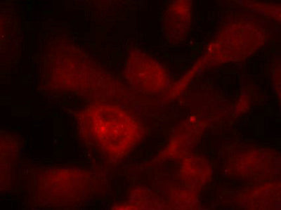 Immunofluorescence staining of methanol-fixed Hela cells using PAK1/PAK2/PAK3(Ab-423/402/421) Antibody.Rabbit anti-Human PAK1/PAK2/PAK3 Polyclonal Antibody