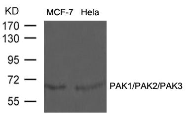 Western blot analysis of extracts from MCF-7 and Hela cells using PAK1/PAK2/PAK3(Ab-423/402/421) Antibody.Rabbit anti-Human PAK1/PAK2/PAK3 Polyclonal Antibody