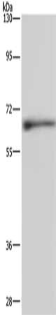 Gel: 10%SDS-PAGE, Lysate: 40 μg, Lane: Human hepatocellular carcinoma tissue, Primary antibody: ELN Antibody(ELN Antibody) at dilution 1/500, Secondary antibody: Goat anti rabbit IgG at 1/8000 dilution, Exposure time: 5 minutesRabbit anti-Human ELN Polyclonal Antibody