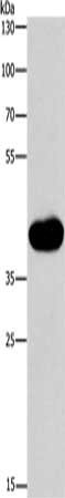 Gel: 8%SDS-PAGE, Lysate: 40 μg, Lane: Mouse intestinum tenue tissue, Primary antibody: MAPK13 Antibody(MAPK13 Antibody) at dilution 1/200, Secondary antibody: Goat anti rabbit IgG at 1/8000 dilution, Exposure time: 1 minute