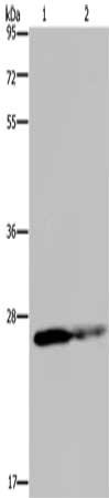 Gel: 8%SDS-PAGE, Lysate: 40 μg, Lane 1-2: HT29 cells, human fetal brain tissue, Primary antibody: GSTP1 Antibody(GSTP1 Antibody) at dilution 1/350, Secondary antibody: Goat anti rabbit IgG at 1/8000 dilution, Exposure time: 10 secondsRabbit anti-Human GSTP1 Polyclonal Antibody