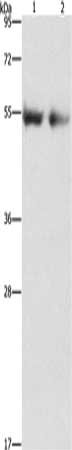 Gel: 8%SDS-PAGE, Lysate: 40 μg, Lane 1-2: Human right lung tissue, Human left lung cancer tissue, Primary antibody: ANGPT4 Antibody(ANGPT4 Antibody) at dilution 1/480, Secondary antibody: Goat anti rabbit IgG at 1/8000 dilution, Exposure time: 2 minutesRabbit anti-Human ANGPT4 Polyclonal Antibody