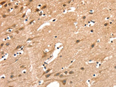 The image on the left is immunohistochemistry of paraffin-embedded Human brain  tissue using AIMP1 Antibody(AIMP1 Antibody) at dilution 1/40, on the right is treated with synthetic peptide. (Original magnification: ×200)Rabbit anti-Human AIMP1 Polyclonal Antibody