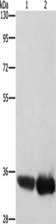 Gel: 8%SDS-PAGE, Lysate: 40 μg, Lane 1-2: Hela cells, hepG2 cells, Primary antibody: AIMP1 Antibody(AIMP1 Antibody) at dilution 1/400, Secondary antibody: Goat anti rabbit IgG at 1/8000 dilution, Exposure time: 5 secondRabbit anti-Human AIMP1 Polyclonal Antibody