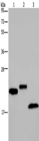 Gel: 10%SDS-PAGE, Lysate: 40 μg, Lane 1-3: NIH/3T3 cells, human testis tissue, mouse fat tissue, Primary antibody: EPPIN Antibody(EPPIN Antibody) at dilution 1/400, Secondary antibody: Goat anti rabbit IgG at 1/8000 dilution, Exposure time: 20 secondsRabbit anti-Human EPPIN Polyclonal Antibody