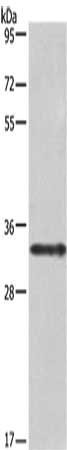 Gel: 8%SDS-PAGE, Lysate: 40 μg, Lane: Jurkat cells, Primary antibody: IL1A Antibody(IL1A Antibody) at dilution 1/666, Secondary antibody: Goat anti rabbit IgG at 1/8000 dilution, Exposure time: 20 secondsRabbit anti-Human IL1A Polyclonal Antibody