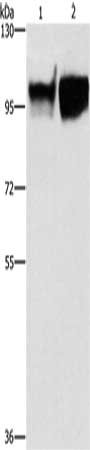 Gel: 6%SDS-PAGE, Lysate: 40 μg, Lane 1-2: Hela cells, raji cells, Primary antibody: ICAM1 Antibody(ICAM1 Antibody) at dilution 1/350, Secondary antibody: Goat anti rabbit IgG at 1/8000 dilution, Exposure time: 30 secondsRabbit anti-Human ICAM1 Polyclonal Antibody