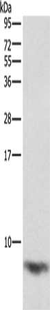 Gel: 12%SDS-PAGE, Lysate: 40 μg, Lane: Mouse heart tissue, Primary antibody: FXYD1 Antibody(FXYD1 Antibody) at dilution 1/1290, Secondary antibody: Goat anti rabbit IgG at 1/8000 dilution, Exposure time: 1 secondRabbit anti-Human FXYD1 Polyclonal Antibody