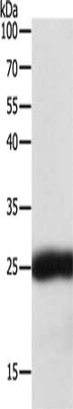 Gel: 12%SDS-PAGE, Lysate: 40 μg, Lane: Hela cells, Primary antibody: SNAP25 Antibody(SNAP25 Antibody) at dilution 1/400, Secondary antibody: Goat anti rabbit IgG at 1/8000 dilution, Exposure time: 3 secondsRabbit anti-Human SNAP25 Polyclonal Antibody