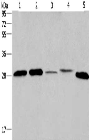 Gel: 10%SDS-PAGE, Lysate: 40 μg, Lane 1-5: HepG2 cells, A549 cells, Hela cells, human fetal liver tissue, mouse liver tissue, Primary antibody: ETFB Antibody(ETFB Antibody) at dilution 1/200, Secondary antibody: Goat anti rabbit IgG at 1/8000 dilution, Exposure time: 40 secondsRabbit anti-Human ETFB Polyclonal Antibody