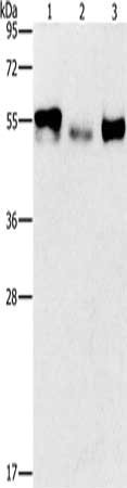 Gel: 8%SDS-PAGE, Lysate: 40 μg, Lane 1-3: Human kidney cancer tissue, Human lung cancer tissue, human placenta tissue, Primary antibody: FOSB Antibody(FOSB Antibody) at dilution 1/200, Secondary antibody: Goat anti rabbit IgG at 1/8000 dilution, Exposure time: 10 minutesRabbit anti-Human FOSB Polyclonal Antibody