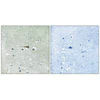 Immunohistochemistry analysis of paraffin-embedded human brain tissue using TTK (Ab-676) antibody.Rabbit anti-Human TTK Polyclonal Antibody