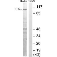 Western blot analysis of extracts from HUVEC cells, treated with etoposide (25uM, 24hours), using TTK (Ab-676) antibody.Rabbit anti-Human TTK Polyclonal Antibody