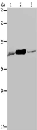 Gel: 8%SDS-PAGE, Lysate: 40 μg, Lane 1-3: 293T cells, Jurkat cells, human fetal muscle tissue, Primary antibody: IDH2 Antibody(IDH2 Antibody) at dilution 1/600, Secondary antibody: Goat anti rabbit IgG at 1/8000 dilution, Exposure time: 10 secondsRabbit anti-Human IDH2 Polyclonal Antibody