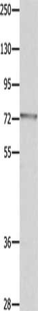 Gel: 10%SDS-PAGE, Lysate: 40 μg, Lane: Mouse eyes tissue, Primary antibody: MUC20 Antibody(MUC20 Antibody) at dilution 1/1400, Secondary antibody: Goat anti rabbit IgG at 1/8000 dilution, Exposure time: 90 secondsRabbit anti-Human MUC20 Polyclonal Antibody