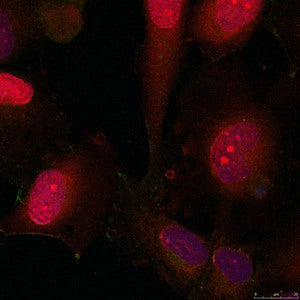 Immunofluorescence staining of methanol-fixed HeLa cells using STAT3(Ab-705) antibody.Rabbit anti-Human STAT3 Polyclonal Antibody