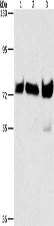 Gel: 6%SDS-PAGE, Lysate: 40 μg, Lane 1-3: Hela cells, Raji cells, 293T cells, Primary antibody: BRAF Antibody(BRAF Antibody) at dilution 1/500, Secondary antibody: Goat anti rabbit IgG at 1/8000 dilution, Exposure time: 20 seconds
