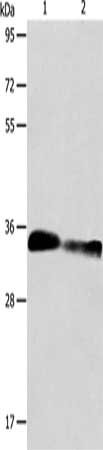 Gel: 10%SDS-PAGE, Lysate: 40 μg, Lane 1-2: Mouse kidney tissue, rat kidney tissue, Primary antibody: ACY3 Antibody(ACY3 Antibody) at dilution 1/750, Secondary antibody: Goat anti rabbit IgG at 1/8000 dilution, Exposure time: 10 secondsRabbit anti-Human ACY3 Polyclonal Antibody
