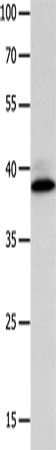 Gel: 10%SDS-PAGE, Lysate: 40 μg, Lane: Human liver cancer tissue, Primary antibody: CFHR1 Antibody(CFHR1 Antibody) at dilution 1/500, Secondary antibody: Goat anti rabbit IgG at 1/8000 dilution, Exposure time: 30 secondsRabbit anti-Human CFHR1 Polyclonal Antibody