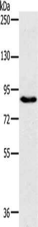 Gel: 6%SDS-PAGE, Lysate: 40 μg, Lane: 231 cells, Primary antibody: PLEKHG6 Antibody(PLEKHG6 Antibody) at dilution 1/800, Secondary antibody: Goat anti rabbit IgG at 1/8000 dilution, Exposure time: 10 secondsRabbit anti-Human PLEKHG6 Polyclonal Antibody