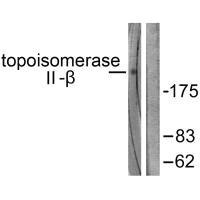 Western blot analysis of extracts from Jurkat cells, using Topoisomerase II β antibody.Rabbit anti-Human TOP2B Polyclonal Antibody