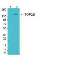 Western blot analysis of extracts from K562 cells (Lane 2), using TOP2B antiobdy. The lane on the left is treated with synthesized peptide.Rabbit anti-Human TOP2B Polyclonal Antibody