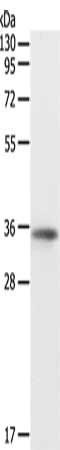 Gel: 12%SDS-PAGE, Lysate: 40 μg, Lane: MCF7 cells, Primary antibody: SOX2 Antibody(SOX2 Antibody) at dilution 1/300, Secondary antibody: Goat anti rabbit IgG at 1/8000 dilution, Exposure time: 45 secondsRabbit anti-Human SOX2 Polyclonal Antibody