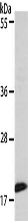 Gel: 8+12%SDS-PAGE, Lysate: 40 μg, Lane: 293T cells, Primary antibody: EIF4EBP1 Antibody(EIF4EBP1 Antibody) at dilution 1/320, Secondary antibody: Goat anti rabbit IgG at 1/8000 dilution, Exposure time: 2 minutesRabbit anti-Human EIF4EBP1 Polyclonal Antibody