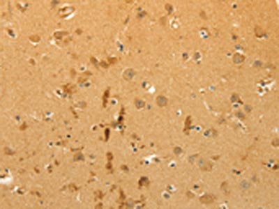 The image on the left is immunohistochemistry of paraffin-embedded Human brain tissue using the antibody Antibody) at dilution 1/40, on the right is treated with fusion protein. (Original magnification: ×200)Rabbit anti-Human CFHR1 Polyclonal Antibody