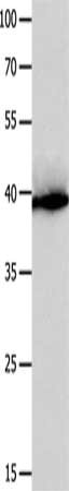 Gel: 10%SDS-PAGE, Lysate: 40 μg, Lane: Human liver cancer tissue, Primary antibody: CFHR1 Antibody(CFHR1 Antibody) at dilution 1/300, Secondary antibody: Goat anti rabbit IgG at 1/8000 dilution, Exposure time: 30 secondsRabbit anti-Human CFHR1 Polyclonal Antibody