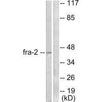 Western blot analysis of extracts from LOVO cells, using Fra-2 antibody.