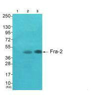 Western blot analysis of extracts from  A549 cells (Lane 2) and HepG2 cells (Lane 3), using Fra-2 antiobdy. The lane on the left is treated with systhesized peptide.
