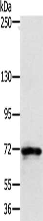 Gel: 6%SDS-PAGE, Lysate: 40 μg, Lane: Mouse spleen tissue, Primary antibody: SEMA7A Antibody(SEMA7A Antibody) at dilution 1/200, Secondary antibody: Goat anti rabbit IgG at 1/8000 dilution, Exposure time: 10 secondsRabbit anti-Human SEMA7A Polyclonal Antibody