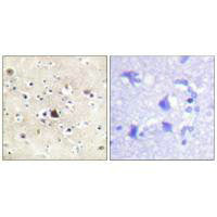 Immunohistochemical analysis of paraffin-embedded human brain tissue using GR (Ab-226) antibody.Rabbit anti-Human NR3C1 Polyclonal Antibody