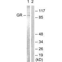Western blot analysis of extracts from Jurkat cells, treated with EGF (200ng/ml, 15mins), using GR (Ab-226) antibody.Rabbit anti-Human NR3C1 Polyclonal Antibody
