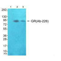 Western blot analysis of extracts from JK cells (Lane 2) and K562 cells (Lane 3), using GR(Ab-226) antiobdy. The lane on the left is treated with synthesized peptide.Rabbit anti-Human NR3C1 Polyclonal Antibody