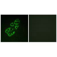 Immunofluorescence analysis of A549 cells, using MtSSB antibody.Rabbit anti-Human SSBP1 Polyclonal Antibody