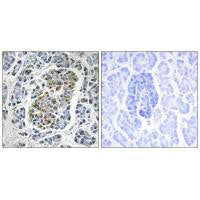 Immunohistochemistry analysis of paraffin-embedded human pancreas tissue using MtSSB antibody.Rabbit anti-Human SSBP1 Polyclonal Antibody