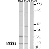 Western blot analysis of extracts from HeLa cells and HUVEC cells, using MtSSB antibody.Rabbit anti-Human SSBP1 Polyclonal Antibody