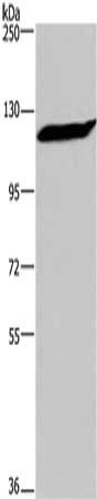 Gel: 6%SDS-PAGE, Lysate: 40 μg, Lane: Hela cells, Primary antibody: IPO7 Antibody(IPO7 Antibody) at dilution 1/300, Secondary antibody: Goat anti rabbit IgG at 1/8000 dilution, Exposure time: 5 minutes