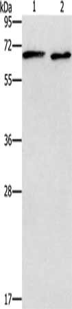 Gel: 10%SDS-PAGE, Lysate: 40 μg, Lane 1-2: PC3 cells, Raji cells, Primary antibody: ADRA1A Antibody(ADRA1A Antibody) at dilution 1/337.5, Secondary antibody: Goat anti rabbit IgG at 1/8000 dilution, Exposure time: 10 secondsRabbit anti-Human ADRA1A Polyclonal Antibody
