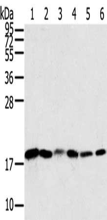 Gel: 12%SDS-PAGE, Lysate: 40 μg, Lane 1-6: Human colon sigmoideum cancer tissue, Human colon cancer tissue, mouse lung tissue, human normal colon tissue, lovo cells, hela cells, Primary antibody: SNX3 Antibody(SNX3 Antibody) at dilution 1/250, Secondary antibody: Goat anti rabbit IgG at 1/8000 dilution, Exposure time: 10 secondsRabbit anti-Human SNX3 Polyclonal Antibody