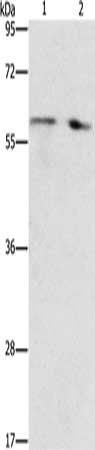 Gel: 10%SDS-PAGE, Lysate: 40 μg, Lane 1-2: Human liver cancer tissue, Human fetal liver tissue, Primary antibody: STEAP4 Antibody(STEAP4 Antibody) at dilution 1/450, Secondary antibody: Goat anti rabbit IgG at 1/8000 dilution, Exposure time: 40 secondsRabbit anti-Human STEAP4 Polyclonal Antibody