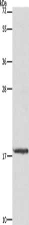 Gel: 10%SDS-PAGE, Lysate: 40 μg, Lane: Mouse stomach tissue, Primary antibody: MYL6 Antibody(MYL6 Antibody) at dilution 1/237.5, Secondary antibody: Goat anti rabbit IgG at 1/8000 dilution, Exposure time: 20 secondsRabbit anti-Human MYL6 Polyclonal Antibody