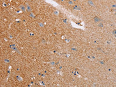 The image on the left is immunohistochemistry of paraffin-embedded Human brain tissue using the antibody Antibody) at dilution 1/20, on the right is treated with fusion protein. (Original magnification: ×200)