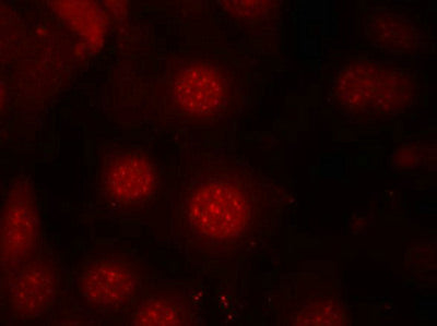 Immunofluorescence staining of methanol-fixed MCF7 cells using AFX(Phospho-Ser197) Antibody.Rabbit anti-Human FOXO4 Polyclonal Antibody