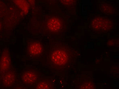 Immunofluorescence staining of methanol-fixed MCF7 cells using AFX(Phospho-Ser197) Antibody.Rabbit anti-Human FOXO4 Polyclonal Antibody