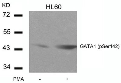 Western blot analysis of extracts from HL60 cells untreated or treated with PMA using GATA1(Phospho-Ser142) Antibody.Rabbit anti-Human GATA1 Polyclonal Antibody